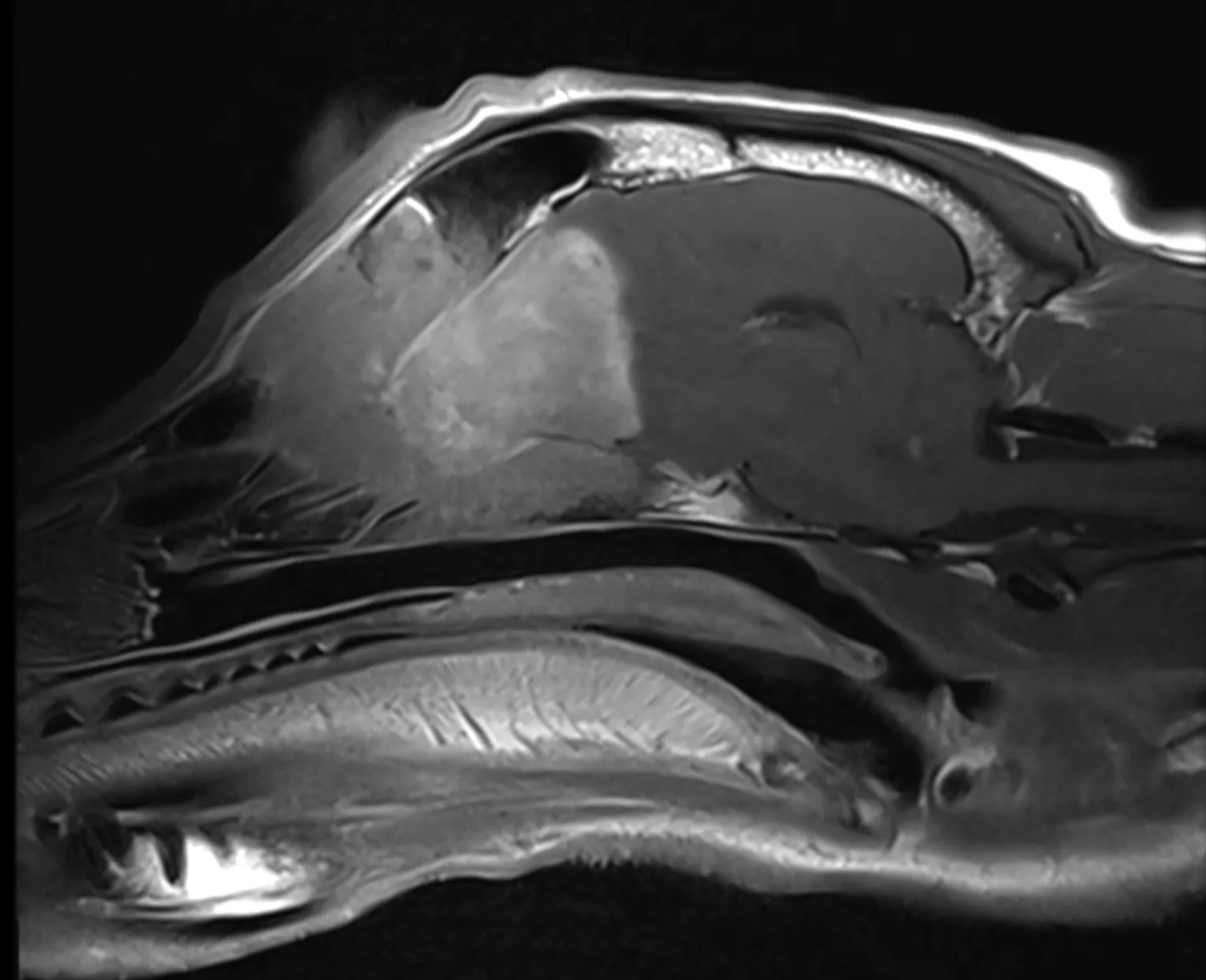 Sagittal T1 med kontrast