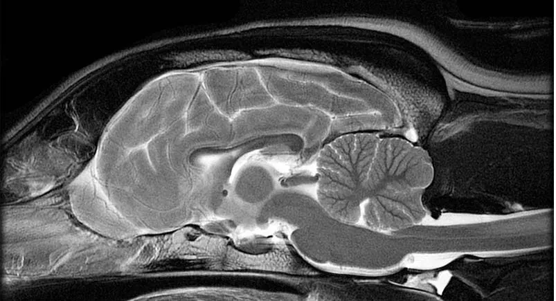 MR · Sagittal hjerne · 1,5 T